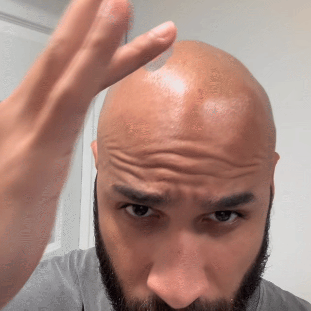 COMPLETE SCALP CARE PROTOCOL